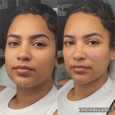 Profile balancing